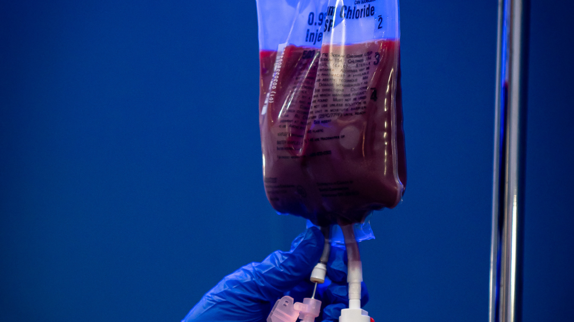 Ozone UV IV therapy for immune system support